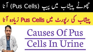 Pus cells in urine urdu hindi  Irfan Azeem [upl. by Azrim462]