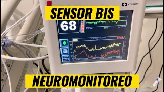 Sensor BIS monitorizacion neurologica [upl. by Etteniotna114]