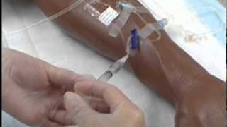 Intravenous IV Therapy Administering IV Medication via a Saline Lock [upl. by Admana]