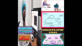 Urine test Uroflowmetry Bangla Uroflowmetry interpretation Urine Uroflowmetry [upl. by Ayatahs]