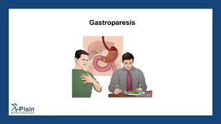 Gastroparesis [upl. by Silvers107]