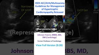 2024 ACCAHAMultisociety Guidelines for Management of Hypertrophic Cardiomyopathy Released [upl. by Freytag806]