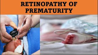 What Causes ROP  Retinopathy of prematurity [upl. by Benito]