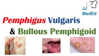 Vesiculobullous Skin Diseases  Pemphigus Vulgaris vs Bullous Pemphigoid [upl. by Anaujnas]