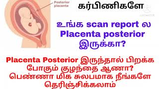 posteriorposterior placenta how to find baby gender in placenta posterior during pregnancy intamil [upl. by Aititel]