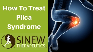 How To Treat Plica Syndrome and Speed Recovery [upl. by Ahsiekal]