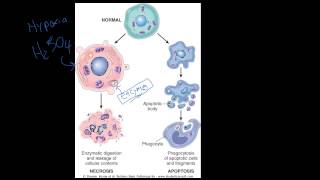 4  Introduction to Pathology  Necrosis vs Apoptosis [upl. by Maryrose]