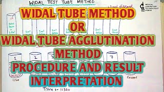 Widal test tube or tube agglutination or tube titration methodprocedure and result interpretation [upl. by Ahsratal]