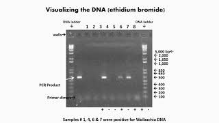 Visualization of Gel Electrophoresis [upl. by Zelle]