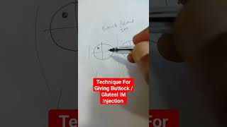 Technique For Giving Buttock Gluteal IM Injection gluteal injection drsaichandra [upl. by Pietje]