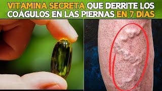 💊🚨 La VITAMINA SECRETA Que Disuelve los Coágulos de Sangre en Tus Piernas 🦵💥 [upl. by Amorita]