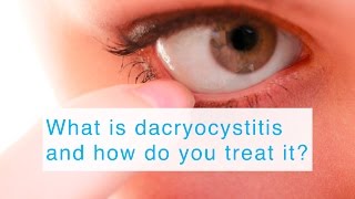 What is dacryocystitis and how do you treat it [upl. by Weixel749]