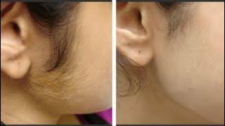 Rica wax tutorial  face wax Rica wax use for face hair remove [upl. by Annaerda]