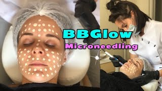 Comment fonctionne BBGlow Visage complet de maquillage permanent [upl. by Ientirb756]