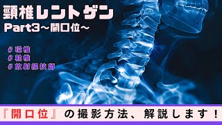 【放射線技師】頸椎レントゲンの撮影方法を現役の放射線技師が解説！～頸椎開口位～ [upl. by Ahsitruc]