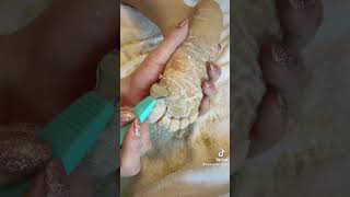 Full foot callus removal  Epidermolytic Palmoplantar Keratoderma  Jan 30 2023 [upl. by Neehsar]