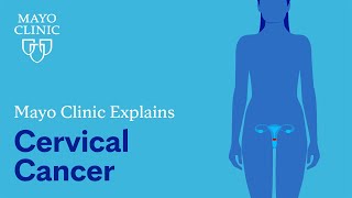 Mayo Clinic Explains Cervical Cancer [upl. by Notsirb]