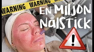 vlogg EN MILJON NÅLSTICK I ANSIKTET 💉 [upl. by Lyontine319]