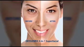 OxyGeneo 3in1 Super Facial Machine [upl. by Nailuj]