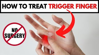 How To Treat Trigger Finger Without Surgery [upl. by Renaxela]