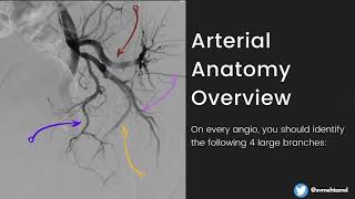 Prostate Artery Embolization From Basics to Advanced [upl. by Gerger]