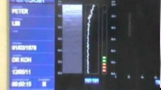 Fibroscan Liver Scanning Procedure  United Italian Trading M Sdn Bhd DAT [upl. by Domela282]