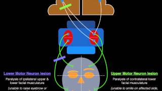 Facial Palsy Upper and Lower Motor Neuron Lesions  Dr MDM [upl. by Jahdal]