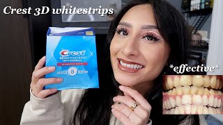 I tried the crest 3D whitestrips for 14 days effective 2023 [upl. by Baniaz]