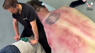 Chiropractor PUTS Full Weight 😳 Into Mans Back To Loosen Tight Joints  Gua Sha amp A CRUNCHY NECK [upl. by Jueta12]