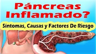 SINTOMAS DE PANCREATITIS AGUDA Y CRONICA Sintomas Del Pancreas Inflamado y Sus Causas [upl. by Lerner991]