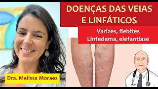 Problemas nas veias e linfáticos varizes tromboses feridas e erisipela Sintomas e tratamento [upl. by Donatelli]