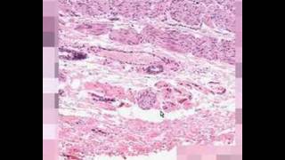 Shotgun Histology GastroEsophageal Junction [upl. by Airpac]