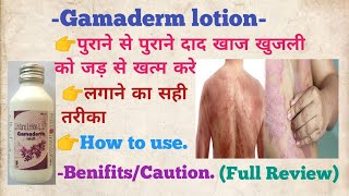 Gamaderm Lotion Lindane Lotionदाद खाज खुजली को जड़ से खत्म करे subscribe how to usevideo short [upl. by Hiltner]