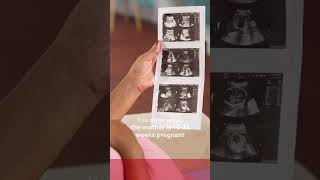 What is Fetal Echocardiography  Genesis Foundation  FAQ [upl. by Atnima]