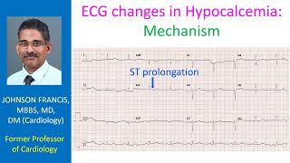 ECG changes in hypocalcemia Mechanism [upl. by Retswerb]