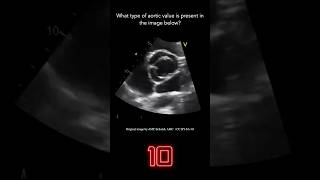 Echocardiography Question 5 [upl. by Enoved]