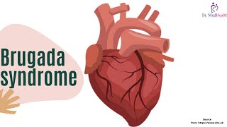 What is Brugada Syndrome  Signs symptoms test and treatment  Cardiac Rhythm [upl. by Henry372]