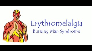 Erythromelalgia Burning Man Syndrome [upl. by Pearline]