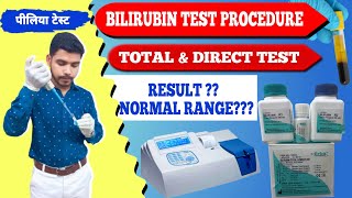 Total amp Direct Bilirubin test procedure practical video पीलिया टेस्टjaundice testserum bilirubin [upl. by Manus]