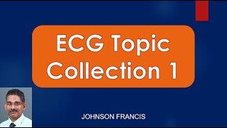 ECG Topic Collection 1 [upl. by Arriec]