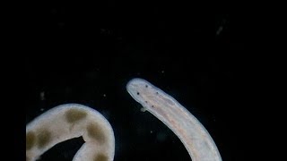 Flatworm With Eggs Under Microscope [upl. by Eerat]