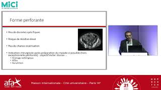 11h40  Questions amp Réponses  Place de la chirurgie dans la maladie de Crohn coliquepar Eddy Cotte [upl. by Arac]