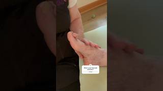 Hammer Toe Treatment clip hammertoetreatment buniontreatment footmassage nomorefootpain [upl. by Ambert]