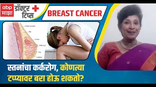 Breast cancer  स्तनांचा कर्करोग लक्षणे आणि उपाय ब्रेस्ट कॅन्सर कोणत्या टप्प्यावर बरा होऊ शकतो [upl. by Batista]