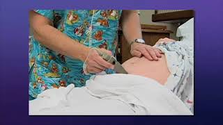 Obstetrical Nursing Electronic Fetal Monitoring [upl. by Warton]