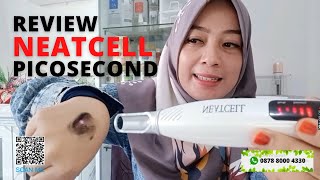 Review NeatCell PICOSECOND Merah dan Biru [upl. by Aikar]