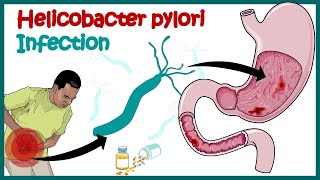 Hpylori Stool Antigen HPSA Test procedure [upl. by Goldstein]