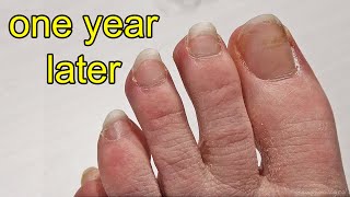 Repainting my Toe Nails After 1 Year of Growing Them Out [upl. by Anuaek]