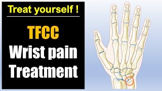 Wrist pain pinky side treatment TFCC injury pain relief massage and exercises [upl. by Notnilk]