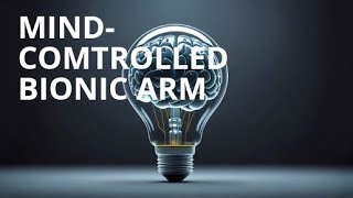 MindComtrolled Bionic Arm [upl. by Ennahtebazile169]